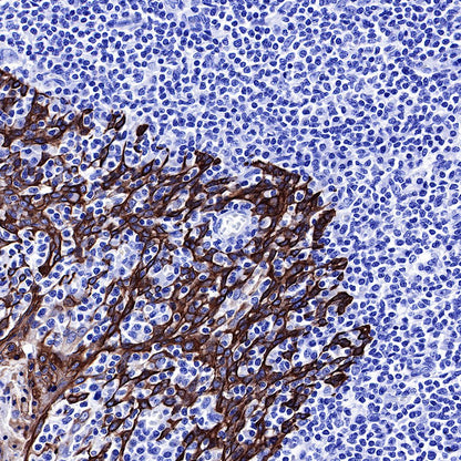 keratin 6 Rabbit mAb (SDT-015-69)