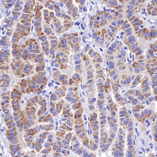 Bcl-xL Recombinant Rabbit mAb (S-487-28)