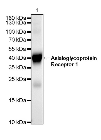 Asialoglycoprotein Receptor 1 Recombinant Rabbit mAb (SDT-292-48)