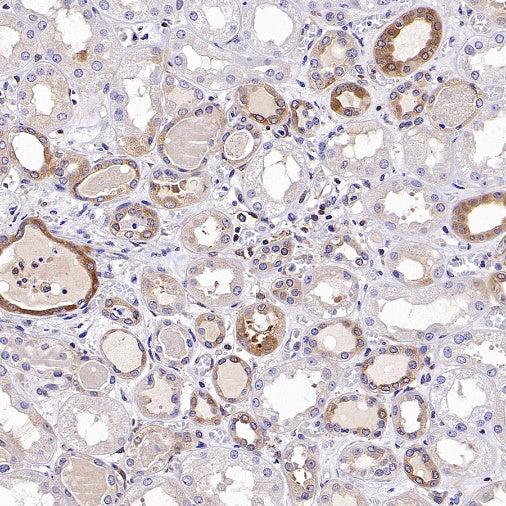 NF-κB2 p100/p52 Recombinant Rabbit mAb (S-2502-70)