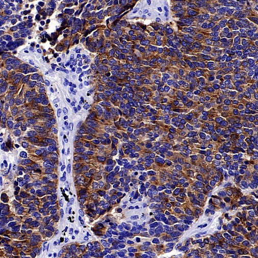 SEZ6 Recombinant Rabbit mAb (SDT-2097-737)