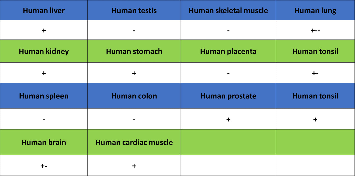 Monoamine Oxidase B/MAOB Recombinant Rabbit mAb (S-5317)