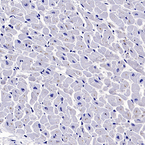 GSDMD Recombinant Rabbit mAb (S-3267)