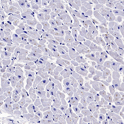 GSDMD Recombinant Rabbit mAb (S-3267)