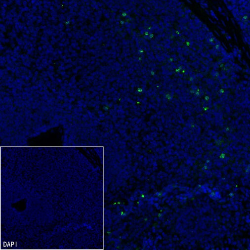 Lipocalin-2/NGAL Recombinant Rabbit mAb (S-2280-129)