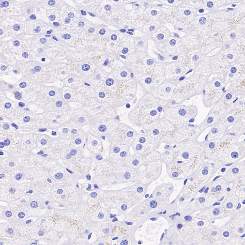 MUC5AC Recombinant Rabbit mAb (SDT-2630-23)