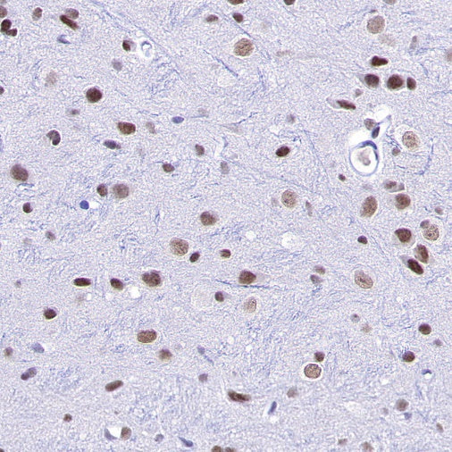 METTL3 Recombinant Rabbit mAb (S-315-219)