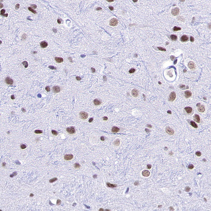 METTL3 Recombinant Rabbit mAb (S-315-219)