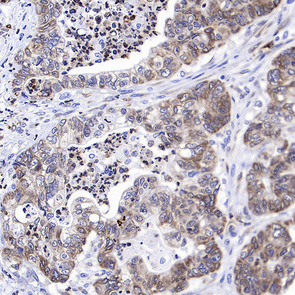 PTGES Recombinant Rabbit mAb (S-4351-18)