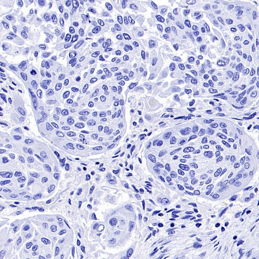 Podoplanin (D2-40) Recombinant Rabbit mAb (SDT-1178-8)