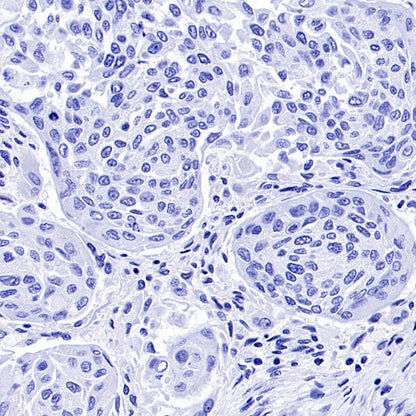 Podoplanin (D2-40) Recombinant Rabbit mAb (SDT-1178-8)