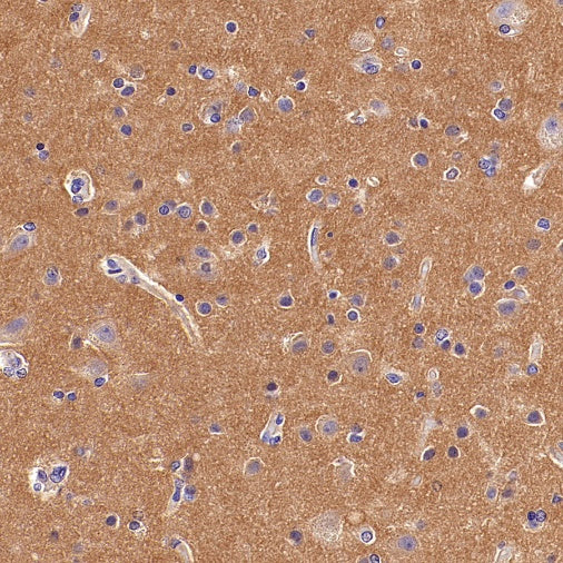 ART1 Recombinant Rabbit mAb (S-2396-1)