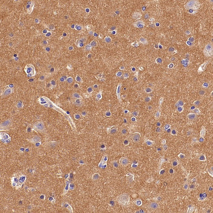 ART1 Recombinant Rabbit mAb (S-2396-1)