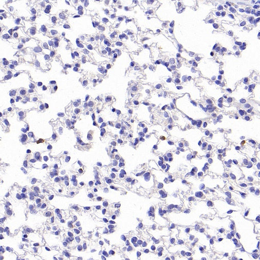 CD25/IL-2Rα Recombinant Rabbit mAb (SDT-2234-65)