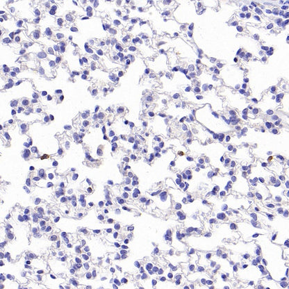 CD25/IL-2Rα Recombinant Rabbit mAb (SDT-2234-65)