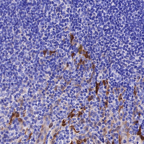 ALDH3A1 Recombinant Rabbit mAb (S-R220)