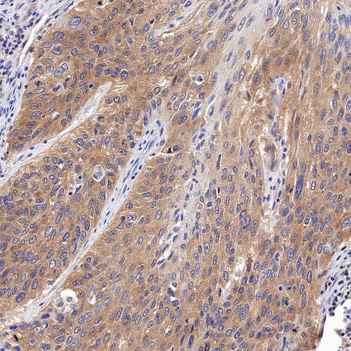 PP2A C Subunit Rabbit polyclonal antibody