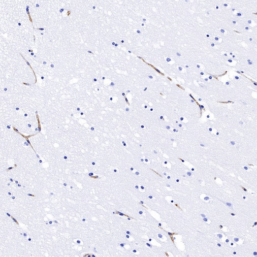 HLA-E Recombinant Rabbit mAb (S-1081-62)