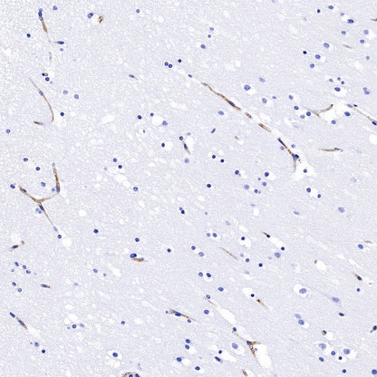 HLA-E Recombinant Rabbit mAb (S-1081-62)