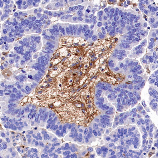 Fibronectin Recombinant Rabbit mAb (S-1475-79)