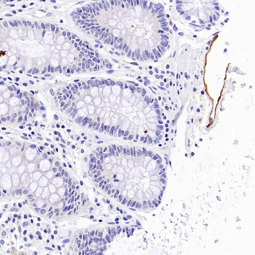 LYVE1 Recombinant Rabbit mAb (S-3786-26)