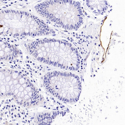LYVE1 Recombinant Rabbit mAb (S-3786-26)