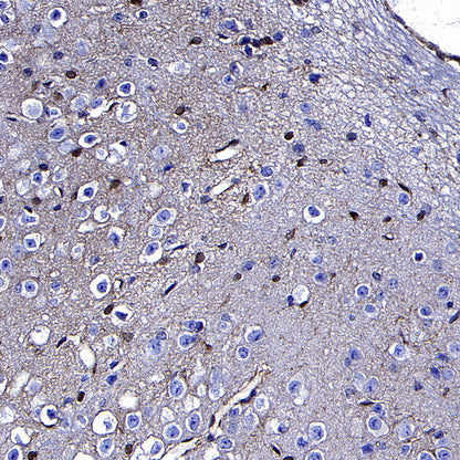 GSTM1 Rabbit Polyclonal Antibody