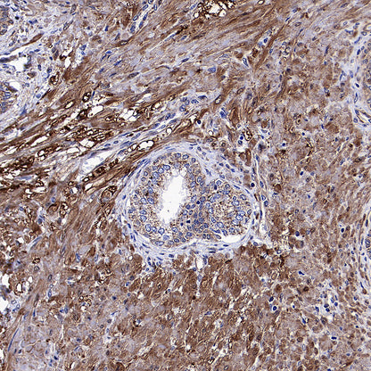 Vinculin Recombinant Rabbit mAb (S-5405)