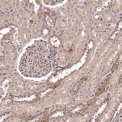 IFIT3 Recombinant Rabbit mAb (S-1893-45)