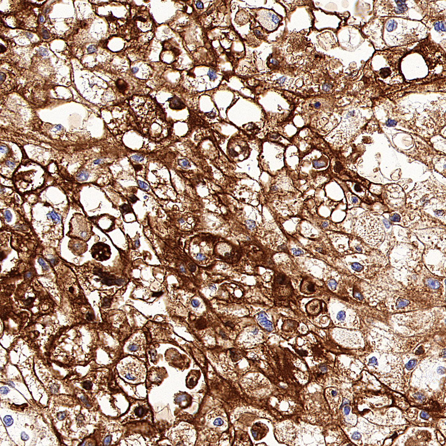 CYP1B1 Recombinant Rabbit mAb (S-6022)