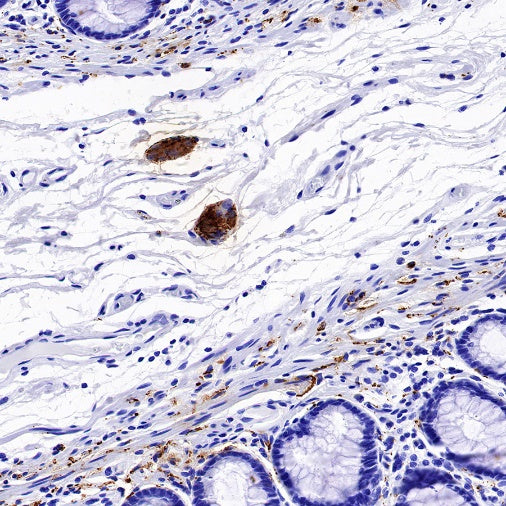 VIP Recombinant Rabbit mAb (S-1116-104)