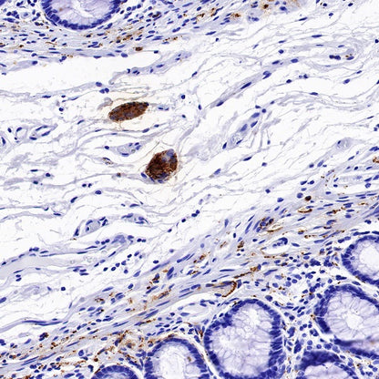 VIP Recombinant Rabbit mAb (S-1116-104)