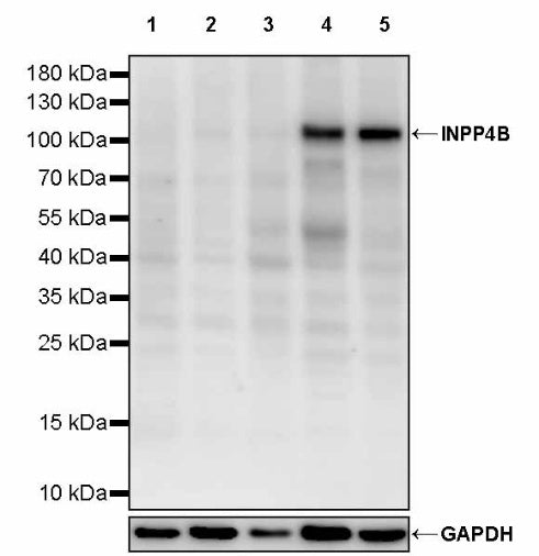 INPP4B Recombinant Rabbit mAb (S-3210-62)
