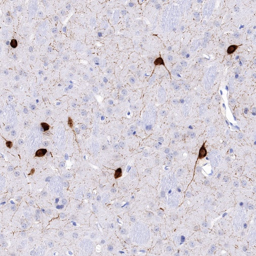 Neuropeptide Y Recombinant Rabbit mAb (S-1104-18)