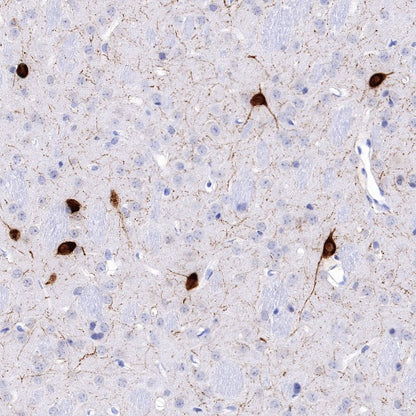 Neuropeptide Y Recombinant Rabbit mAb (S-1104-18)