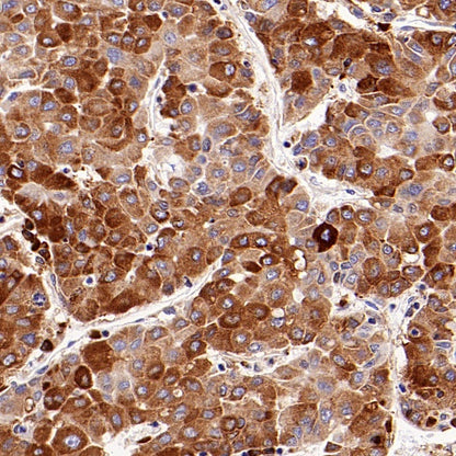 Cyclophilin B Recombinant Rabbit mAb (S-1543-63)