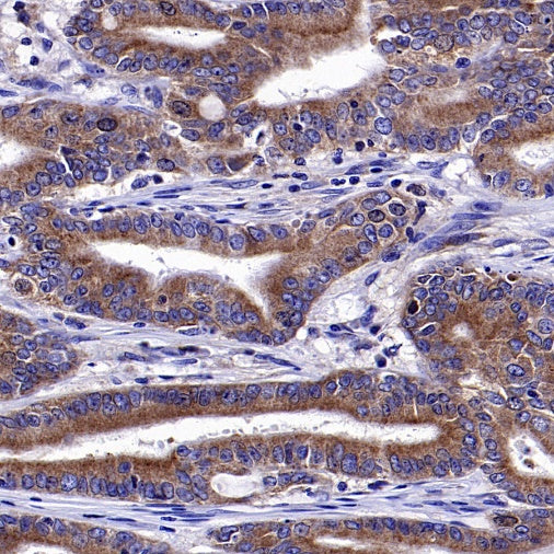ATP7A Recombinant Rabbit mAb (S-2289-106)