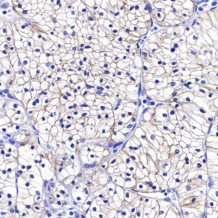 N-Cadherin Recombinant Rabbit mAb (SDT-329-12)