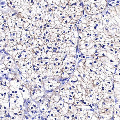 N-Cadherin Recombinant Rabbit mAb (SDT-329-12)