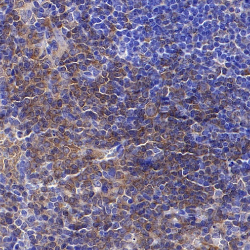 BTK Recombinant Rabbit mAb (SDT-2105-37)