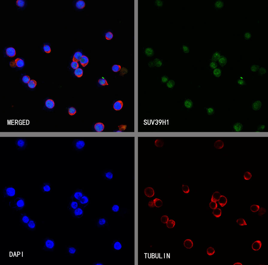 SUV39H1 Recombinant Rabbit mAb (S-3563-3)