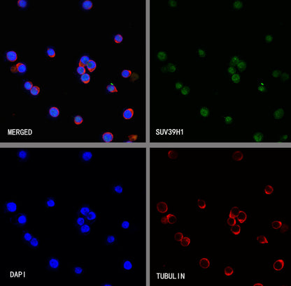 SUV39H1 Recombinant Rabbit mAb (S-3563-3)