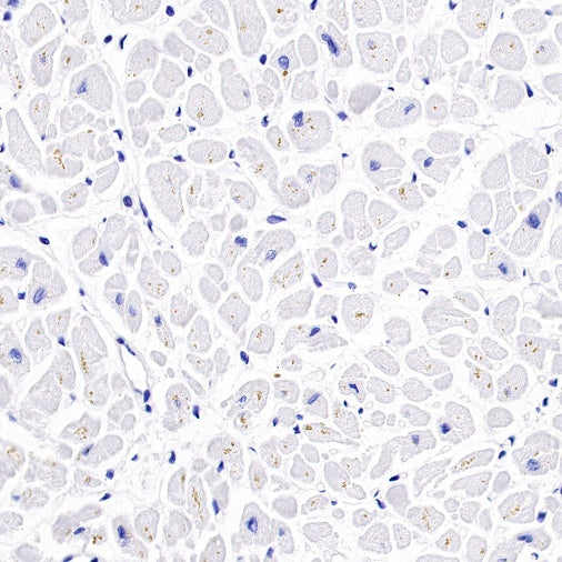 PRMT1 Recombinant Rabbit mAb (S-884-10)