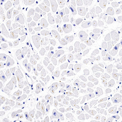 PRMT1 Recombinant Rabbit mAb (S-884-10)