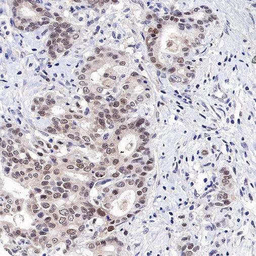 MCM6 Recombinant Rabbit mAb (S-899-23)