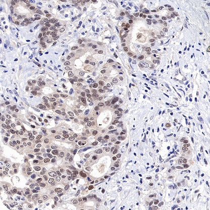 MCM6 Recombinant Rabbit mAb (S-899-23)