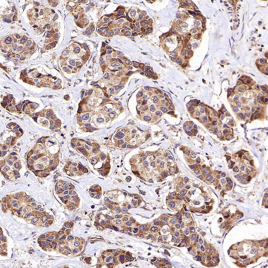 KCNMA1 Recombinant Rabbit mAb (S-2926-33)
