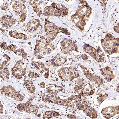 KCNMA1 Recombinant Rabbit mAb (S-2926-33)