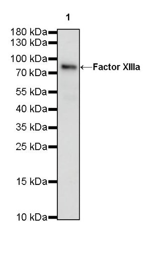 Factor XIIIa Recombinant Rabbit mAb (SDT-644-7)