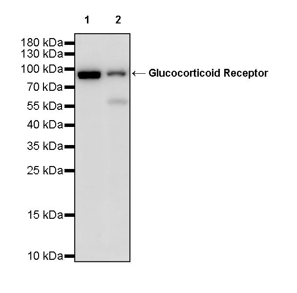 Glucocorticoid Receptor Recombinant Rabbit mAb (S-M0030)